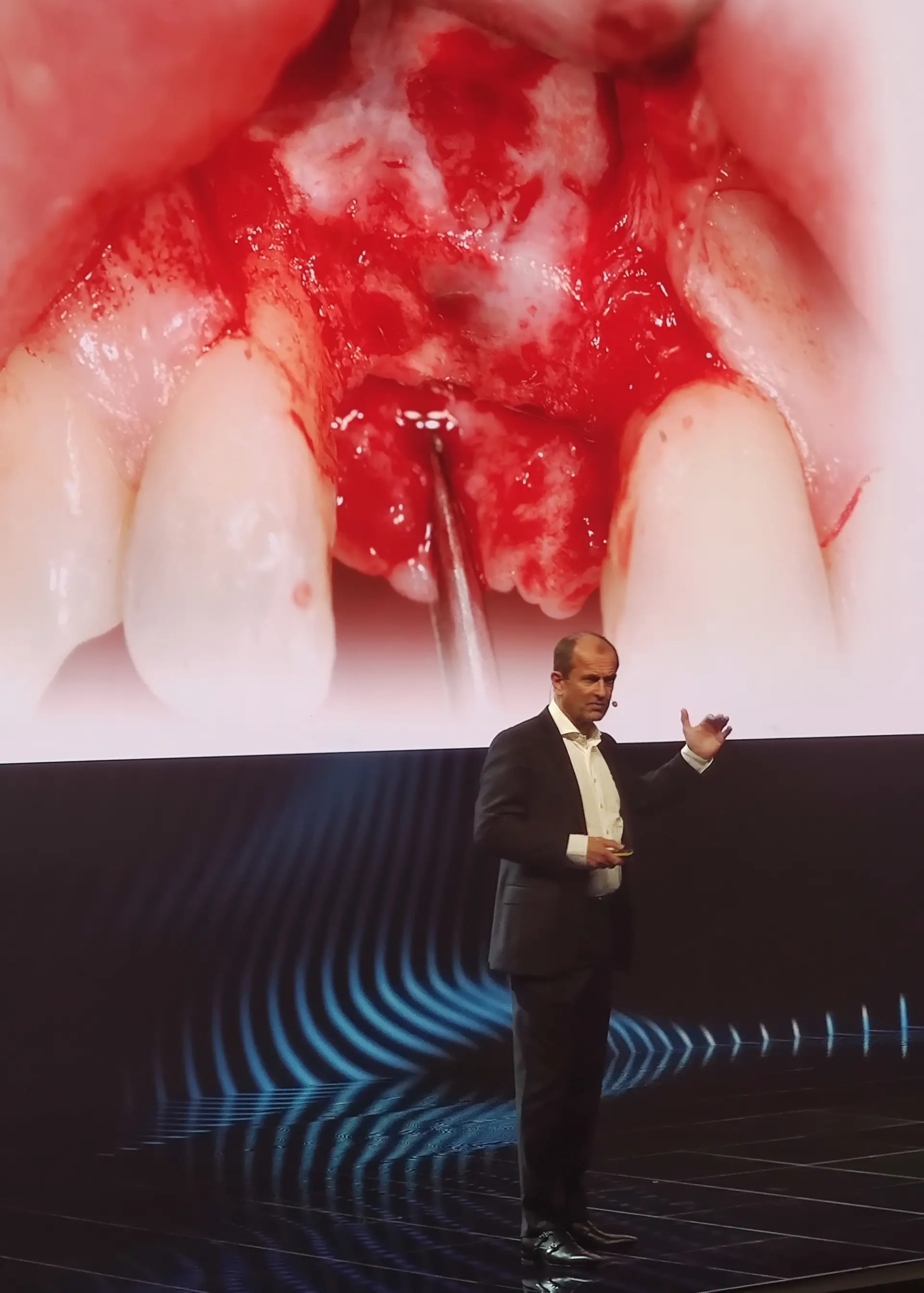 Dr. Norbert Haßfurther als Referent auf einem Implantologie-Kongress in London.