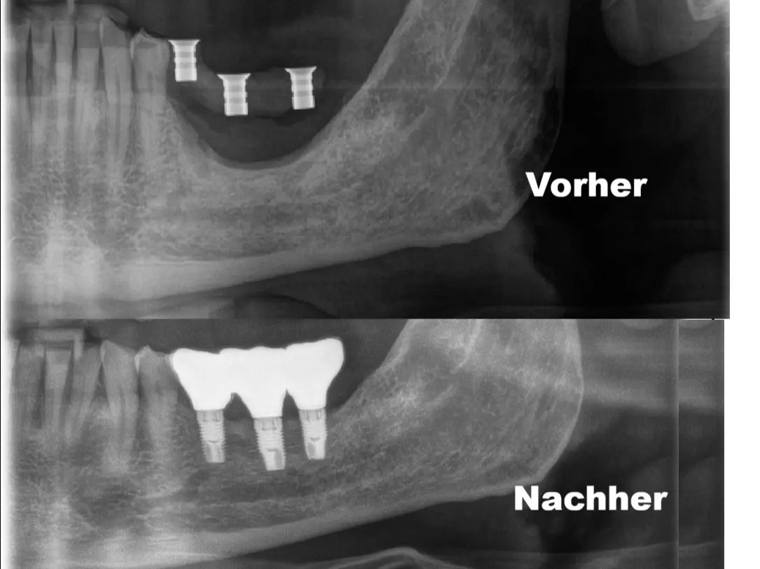 Bild 10 mit Vorher / Nachher Vergleich